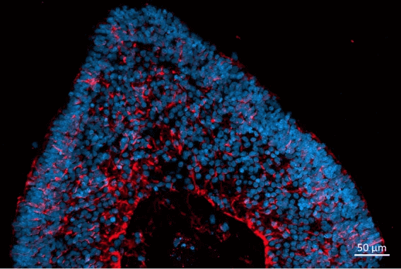 Localization and distribution of Müller glia cells (CRALBP, red) in retinal organoids. Nuclear DAPI staining (blue).
