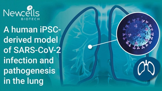 A human iPSC-derived model of SARS-CoV-2 infection and pathogenesis in the lung