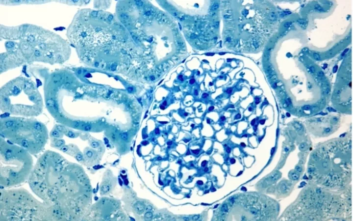 Glomerulus surrounded by convoluted tubules