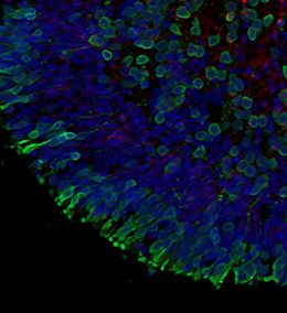 Newcells Biotech to develop 3D retinal organoids using hiPSC derived skin cells