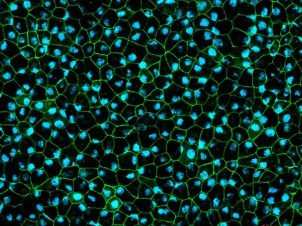 The retina and retinal pigment epithelium (RPE)