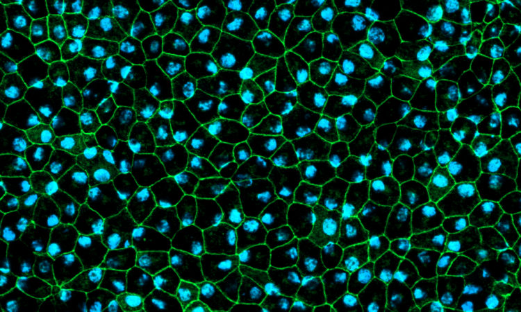 iPSC-derived retinal pigment epithelial (RPE) cells