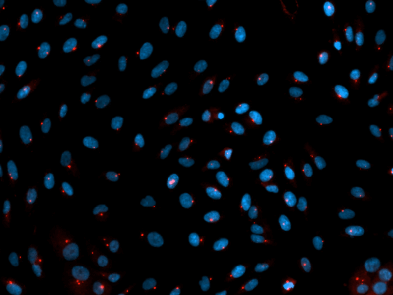 Isolated primary podocyted immunostained for Cilia