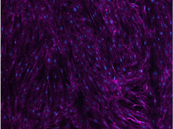 Human Lung Fibroblasts stimulated with TGF-β for 72 hours and immunostained to detect collagen I, as a measure of extracellular matrix production and deposition.