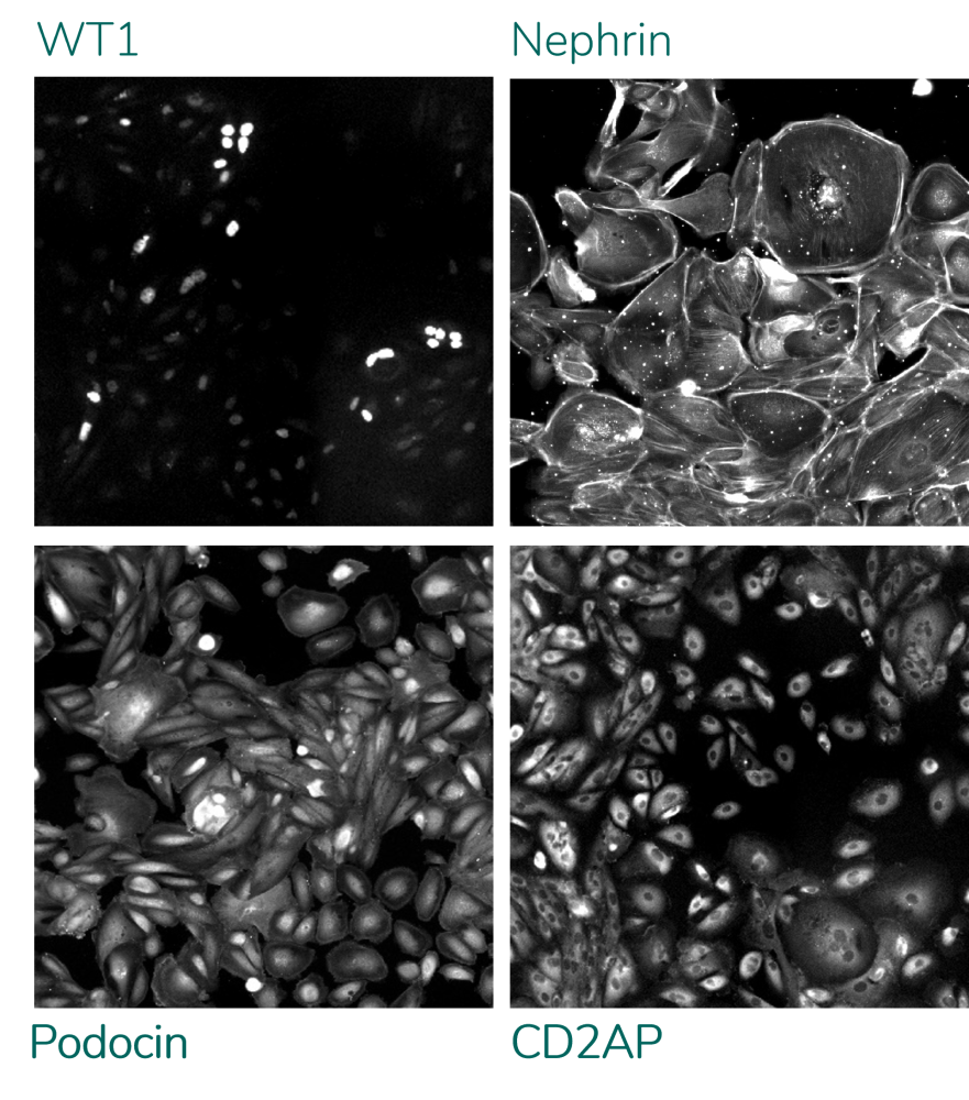 Glomerulus | Newcells Biotech