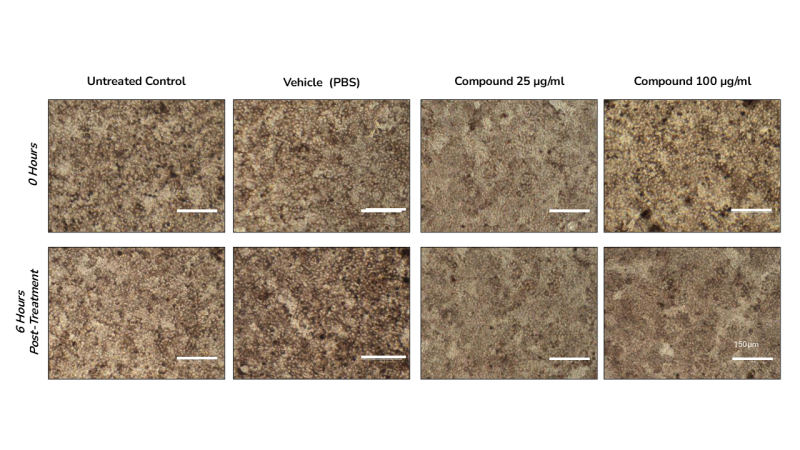 Testing the effect of novel therapeutic on retinal organoids