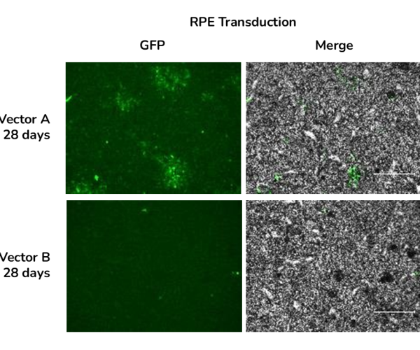 GFP immunofluorescence and brightfield images of RPE