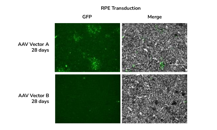 GFP immunofluorescence and brightfield images of RPE