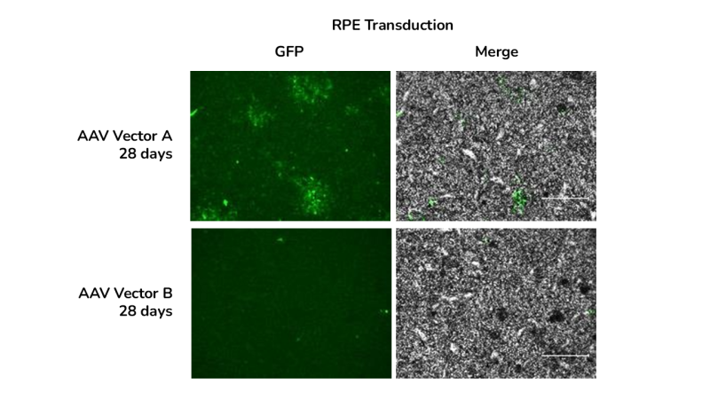 GFP immunofluorescence and brightfield images of RPE